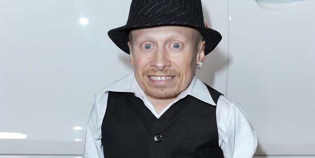 Verne Troyer El Miniyo De Austin Powers Hospitalizado