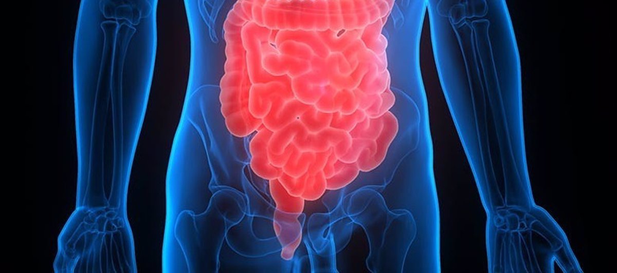 Las personas con enfermedad inflamatoria intestinal tienen más microplásticos en sus heces