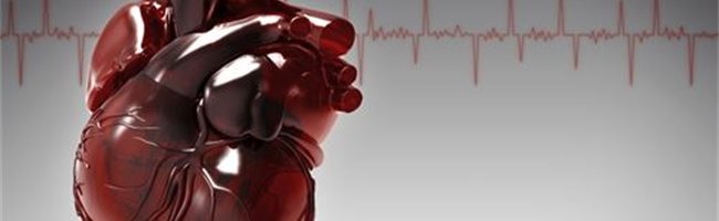 Despido libro de bolsillo Cuidar Qué es la arritmia | Cardiología y salud del corazón | Infosalus