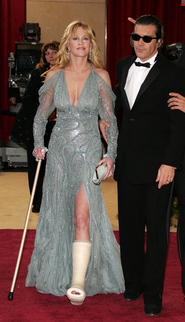 Melanie Griffith y Antonio Banderas en los Oscar 2005. La actriz va con bastón y escayola en la pierna izquierda. La madre de Dakota, lleva una abertura lateral y no dudó en mostrar su escayola.