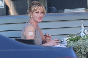 El borrado progresivo del tatuaje de Melanie Griffith
