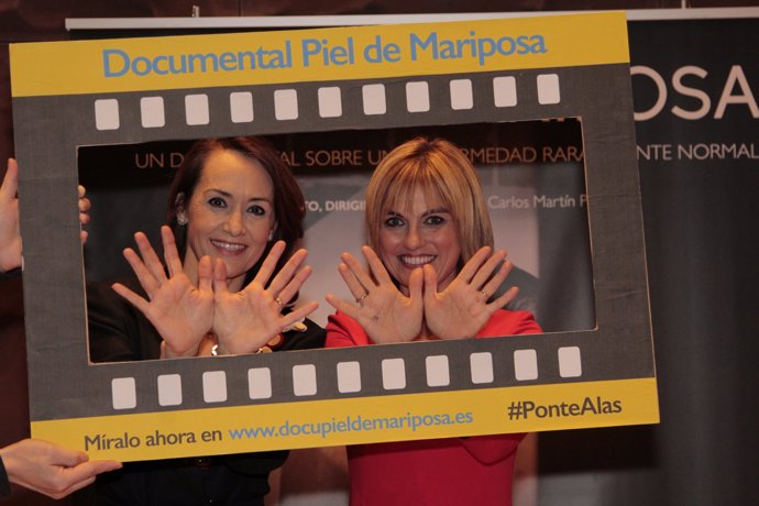 Lourdes Maldonado está Nieves Montero, Presidenta de la Asociación Debra España (o Asociación Piel de Mariposa)