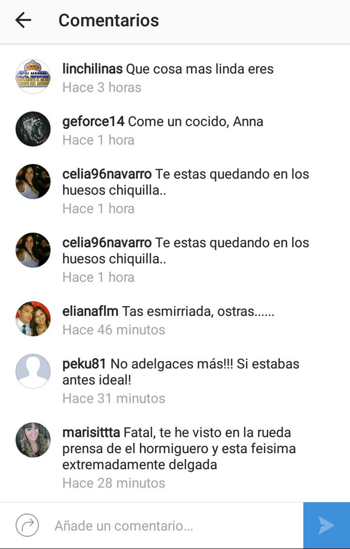 críticas a anna simon por su estrema delgadez