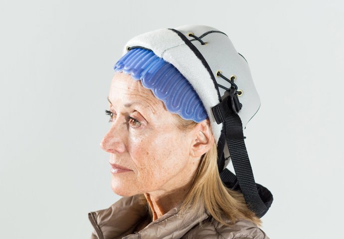 Una nueva tecnología contra la caída del cabello durante la quimio