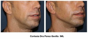 Llega la solución antienvejecimiento perfecta para los hombres