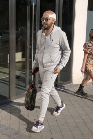 El cordobés confesó estar muy dolorido tras la intervención en la que se realizó un transplante de pelo