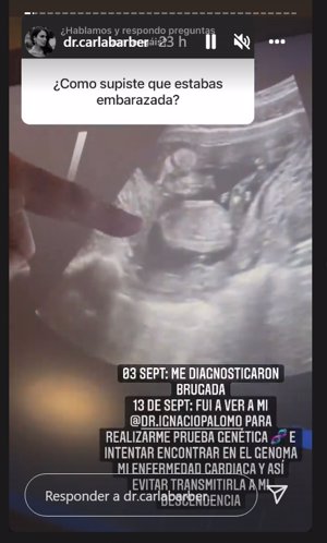 Carla ha contado los detalles de su embarazo en Instagram