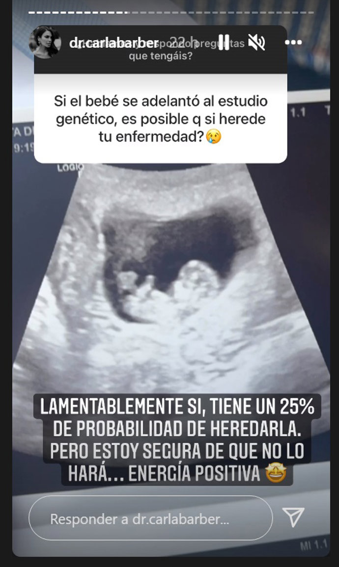 Carla Barber espera su primer hijo para mayo
