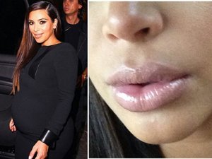 INSTAGRAM KIM KARDASHIAN: Los labios de Kim Kardashion están fuera de control