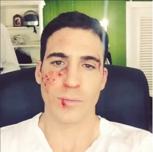 El rostro 'ensangrentado' de Miguel Ángel Silvestre