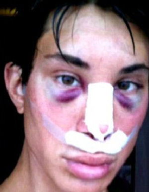 FOTOS: TWITTER Y FACEBOOK