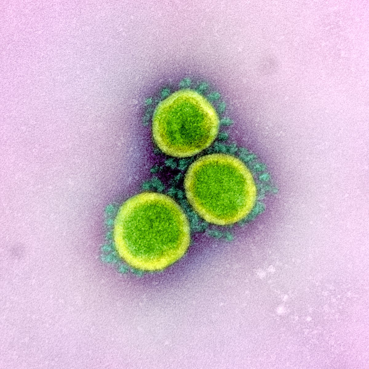 No, no es cierto que los virus no existen porque son demasiado grandes para atravesar los poros de la membrana celular