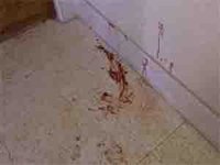 Fallece en Las Rozas una mujer boliviana tras recibir siete puñaladas de su ex pareja