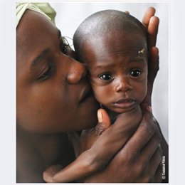 Acción Contra el Hambre