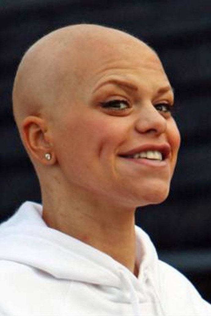 Jade Goody fallece tras seis meses de lucha contra el cáncer