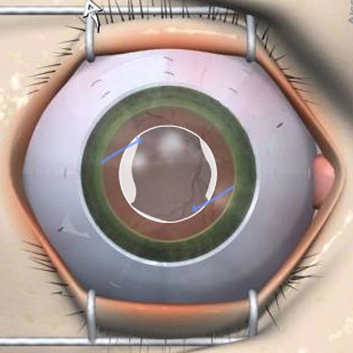 Una nueva tecnología permitirá cámaras con giga y tera pixeles