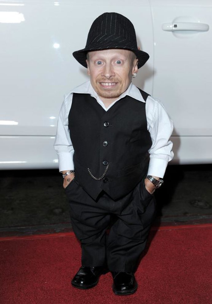 El actor Verne Troyer