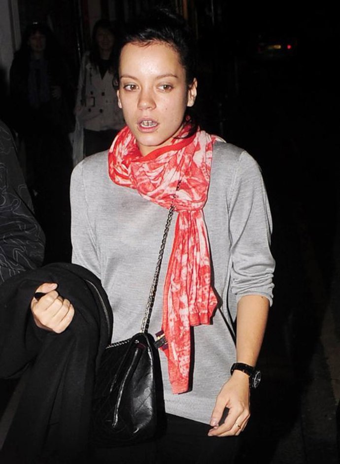 La cantante Lily Allen