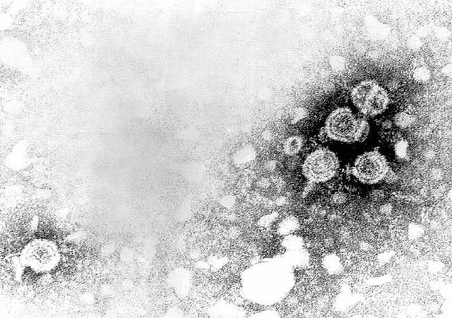 Virus De La Hepatitis