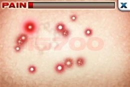 Zits & Giggles, aplicación para iPhone de Tommy Refenes