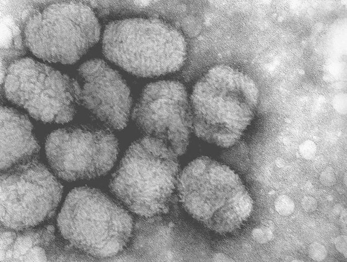 Virus De La Viruela