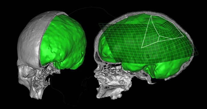 Comparativa De Los Lóbulos Temporales De Un Hombre Moderno Y De Una Especie Exti