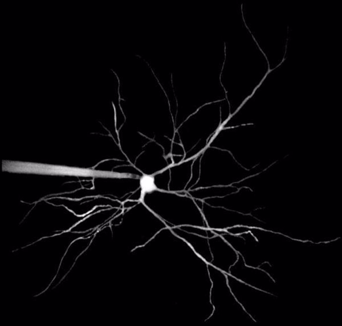 Dendritas Neuronas