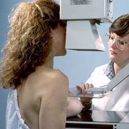 mamografía