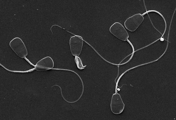 Espermatozoides en gacelas
