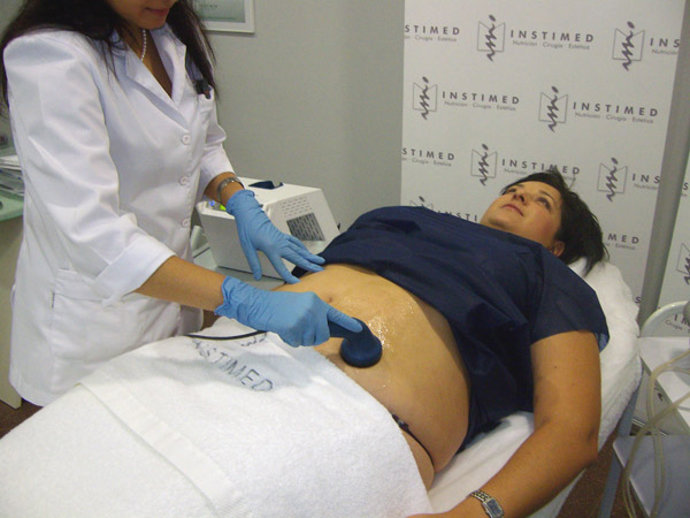 Sistema anti estrías Striak