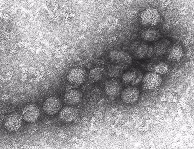 Virus Del Nilo Occidental