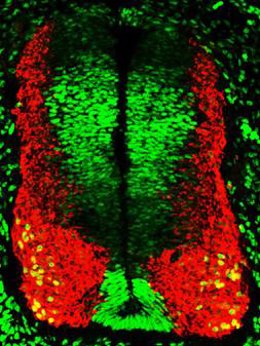 Gen clave para la proliferación celular en el sistema nervioso