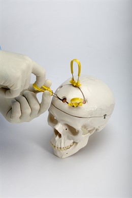 Método de sujeción de cráneo 'Cranial Loop'