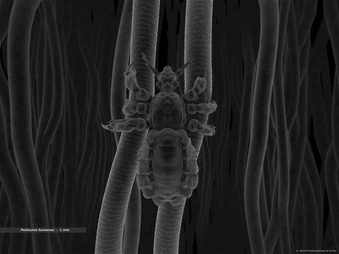 Un piojo en cabellos humanos visto por nanocámara