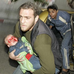 Niño herido en Gaza