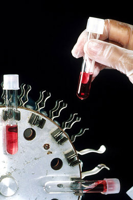 Probar fármacos sobre células madre podría ser la solución