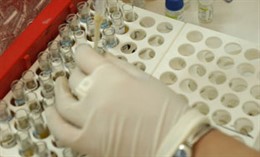 Material de laboratorio