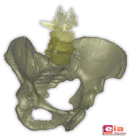 Paleontólogos Españoles Descubren En Atapuerca Los Restos Fósiles De Un Anciano 
