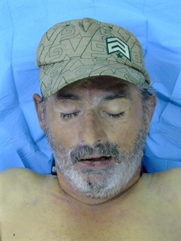 Cadáver sin identificar.