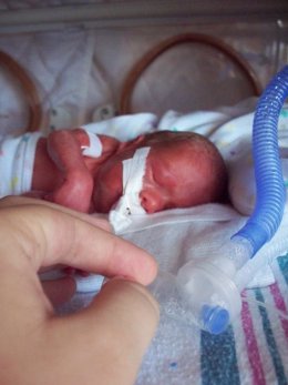 Bebé prematuro, incubadora