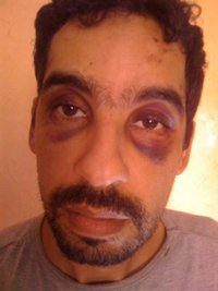 Denuncian que un ciudadano español fue "salvajemente torturado"