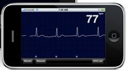 aplicación iPhonECG para iPhone para realizar electrocardiogramas desde  AliveCo