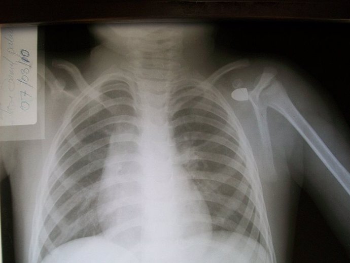 Radiografía, rayos X, radiología, técnicas de imagen