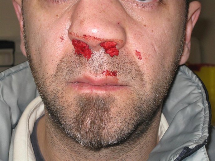 Nota De Prensa Acaip Teixeiro