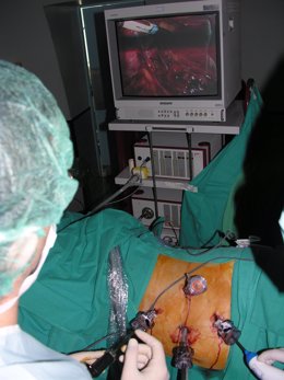 laparoscopia, operación, intevención, hospital, quirófano