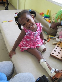 Verónica, niña con mutilación