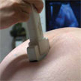 Los centros de salud dispondrán de 14 nuevos ecógrafos