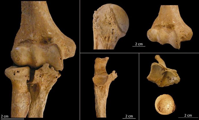 Imágenes sobre un estudio antropolígico en Marialba