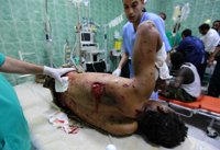 Amnistía Internacional confirma el uso de bombas de racimo en Libia 