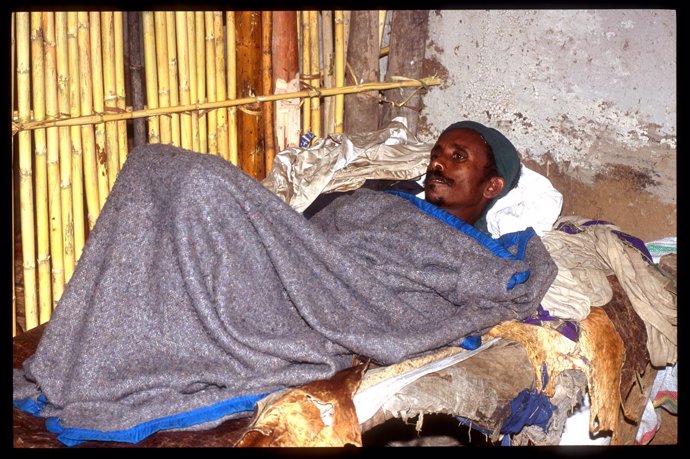 Paciente Con Malaria En Etiopia